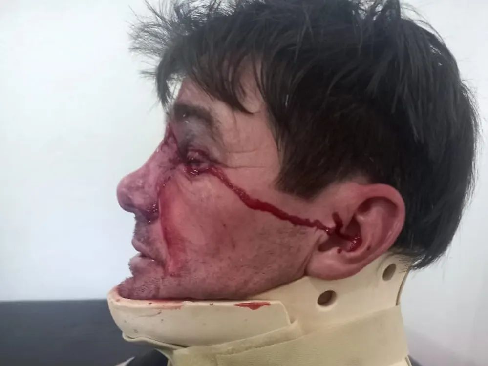 Un ciclista fue agredido por otro en un entrenamiento competitivo de bicicletas de carrera