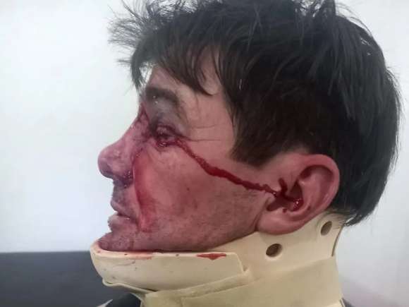 Un ciclista fue agredido por otro en un entrenamiento competitivo de bicicletas de carrera