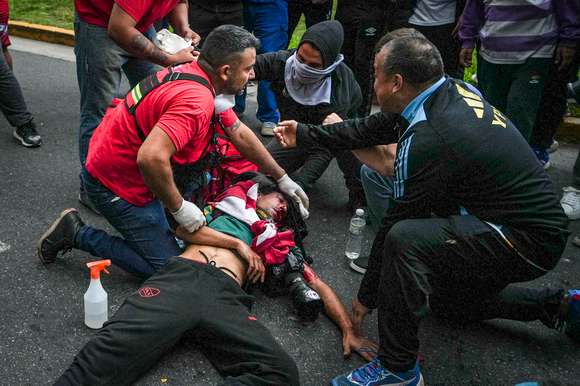 El fotógrafo herido durante la marcha en el Congreso permanece en terapia intensiva